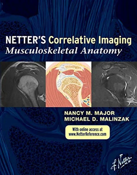 Netter's Correlative Imaging: Musculoskeletal Anatomy Nancy M. Major ürün görseli 1