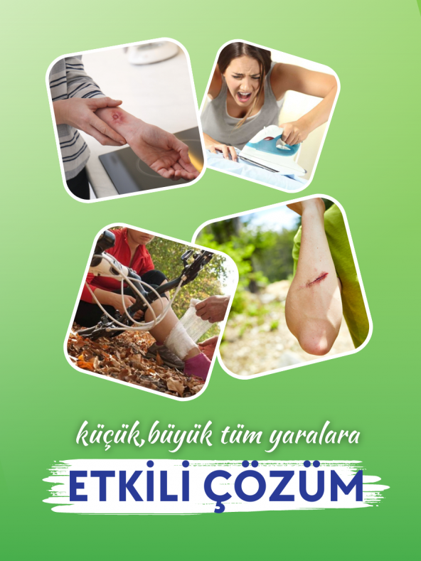 ACTOLIND® W SOLUTION 1 LT | Yara İyileştirme Solüsyonu - Resim 3