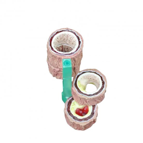 Damar Maketi Model 45 - Resim 3