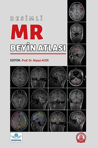 Resimli MR Beyin Atlası - Resim 2