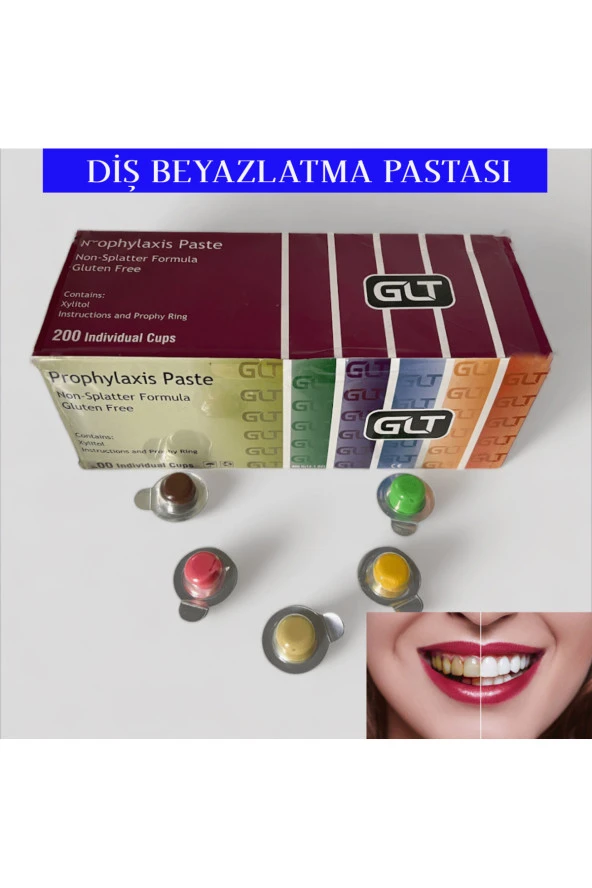 GLT Diş Beyazlatma ve Temizleme Pastası / 20 Adet ürün görseli 1