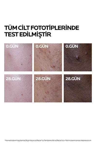 La Roche-Posay Effaclar Duo+M 40 ml - Resim 4