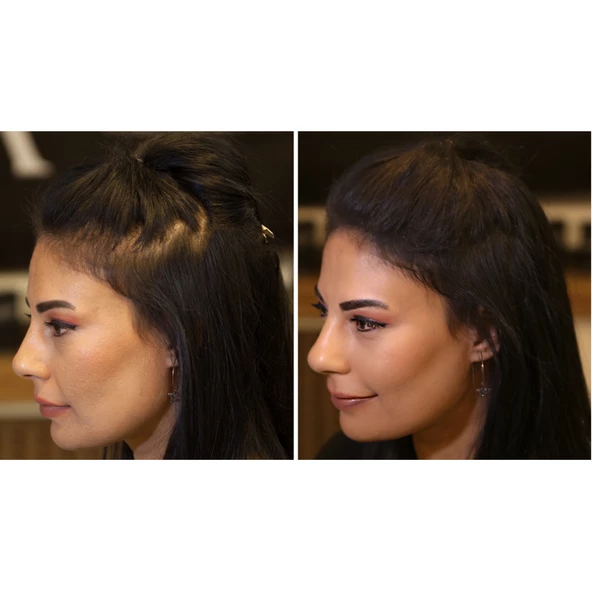 Fixdeep Yeni Nesil Saç Dolgunlaştırıcı Pudra 14 Gr Seyrek Saçlar Için Saç Fiberi Fixdeep Suda çıkmaz