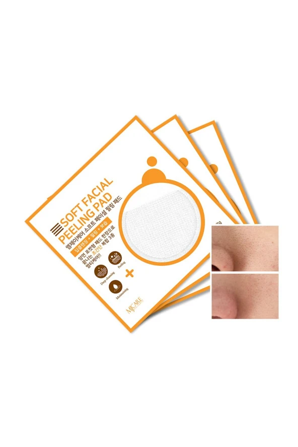 Mjcare Face Peeling 3'lü ürün görseli 1