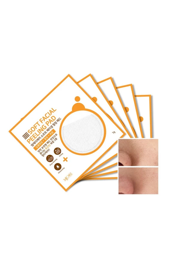 Mjcare Face Peeling 5'li ürün görseli 1