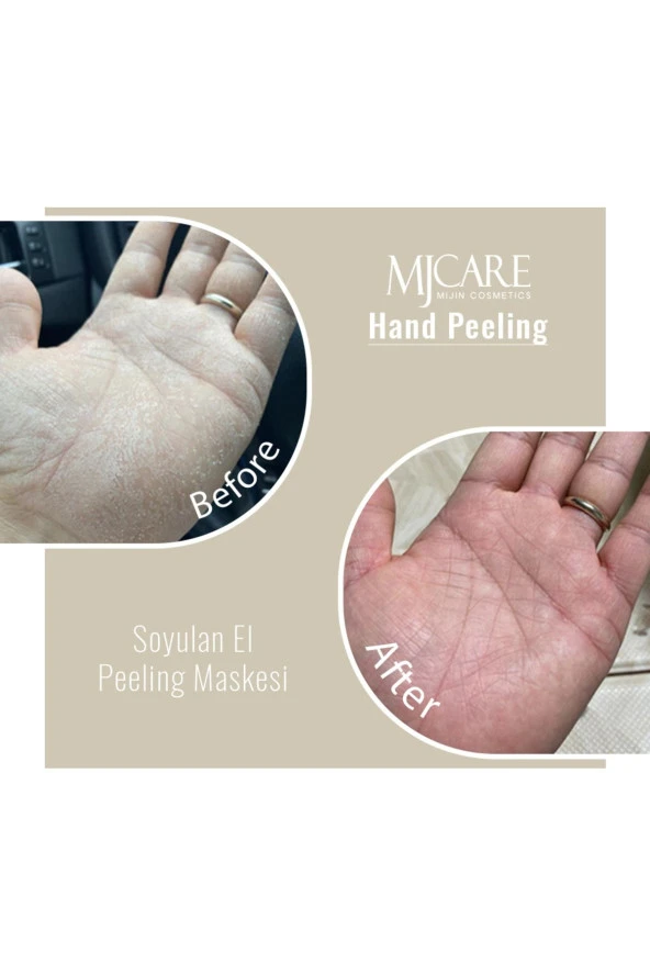 Mjcare 4'lü Peeling Set - Resim 4