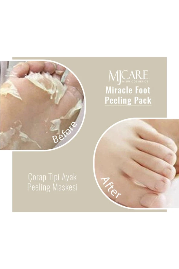 Mjcare 4'lü Peeling Set - Resim 5