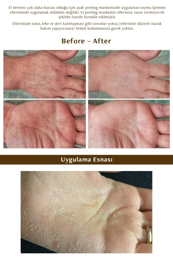 Mjcare Hand Peeling - Soyulan El Peeling Maskesi - Resim 3
