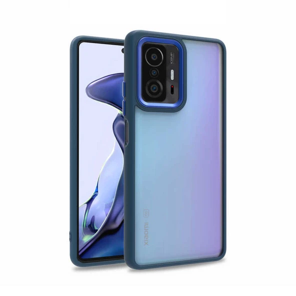 Xiaomi Mi 11T 5G Kılıf  Flora Kapak ürün görseli 1