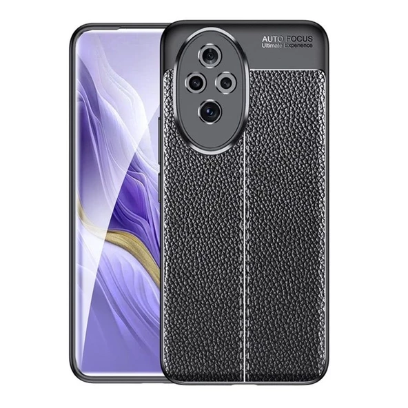 Gpack Honor 200 Pro Kılıf Niss Silikon Kamera Korumalı Deri Görünümlü ürün görseli 1