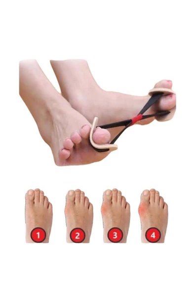 Ayak Baş Parmak Kemik Düzeltici Bunyon Hallux Vagus Egzersiz Lastik Bunyon ürün görseli 1